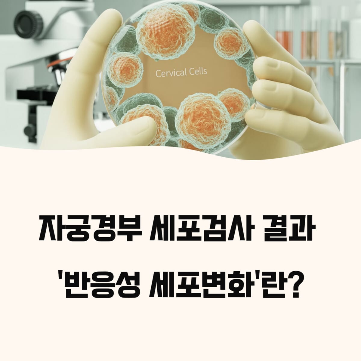 '반응성 세포변화'란?