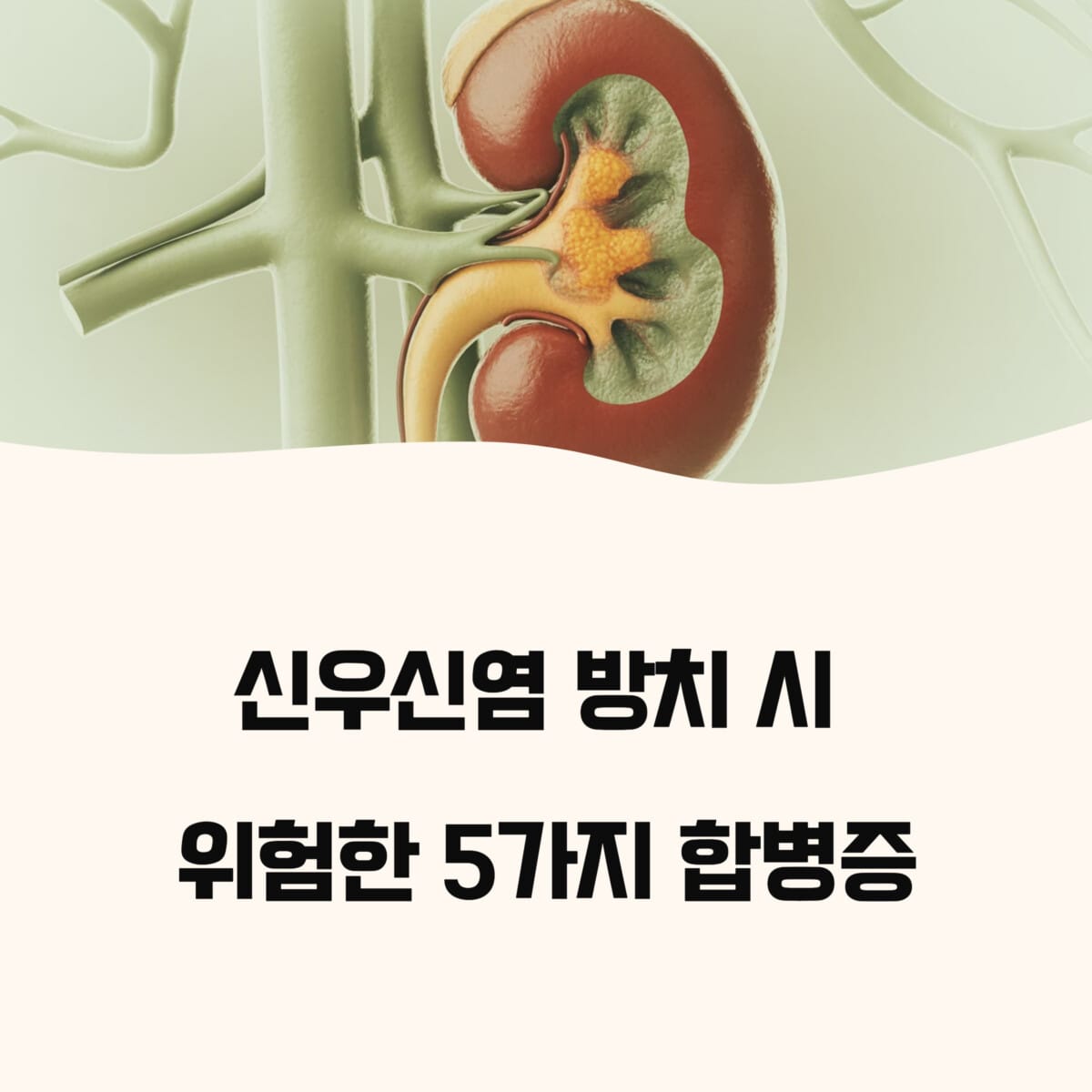 신우신염 방치 시 위험한 5가지 합병증